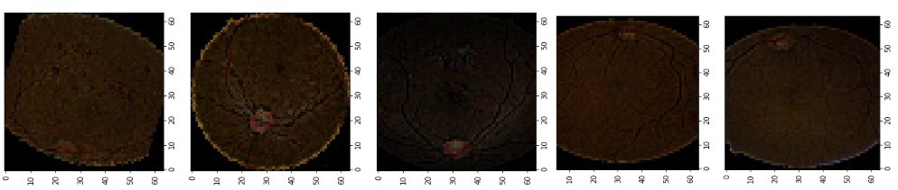 28_implementation_of_data_augmentation_image_processing