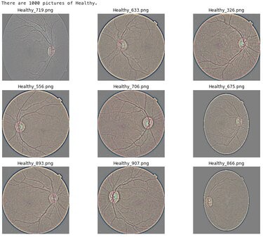 09_implementation_of_data_augmentation